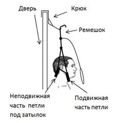 Петля Гліссона (Глісон)