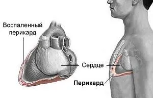 Чому з'являється біль у грудній клітці при вдиху