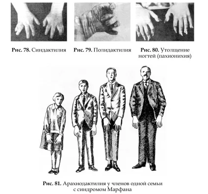 Поняття про молекулярні (генних) хворобах людини (молекулярних) Поняття про молекулярні (генних) хворобах людини