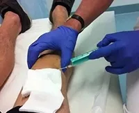 Ознаки та лікування подагри у чоловіків ніж небезпечно захворювання в будь-якому віці (організмі сечової кислоти) Ознаки та лікування подагри у чоловіків ніж небезпечно захворювання в будь-якому віці