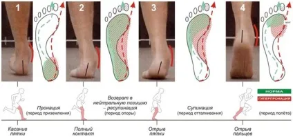 Пронація стопи, що це