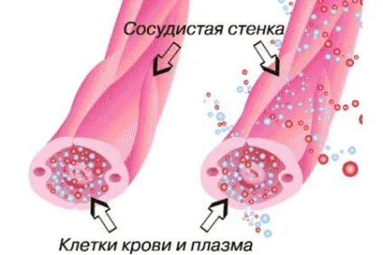 Плями на ногах коричневі, темні, червоні, білі що вони означають і як лікувати (ногах) Плями на ногах коричневі, темні, червоні, білі що вони означають і як лікувати