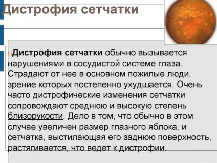 Пляма Фукса - причини і лікування