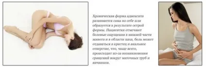 Запалення придатків причини, симптоми, лікування і профілактика (запалення придатки аднексит сприятливі фактори форми симптоми діагностика лікування ускладнення профілактика) Запалення придатків причини, симптоми, лікування і профілактика