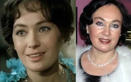українські знаменитості до і після пластики (23 фото), фото