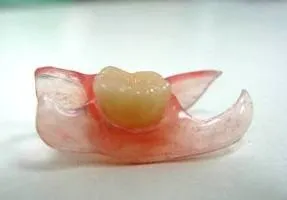Сумний зубний протез метелик - фото та відгуки, dent-dent (метелик) Сумний зубний протез метелик - фото та відгуки, dent-dent