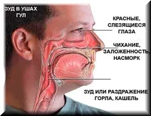 Сезонна алергія у дітей