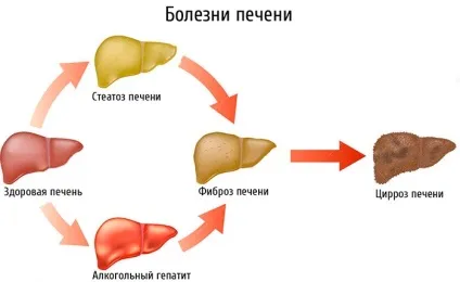 З якого боку і де знаходиться печінка у людини (фото), які симптоми при цирозі печінки і як (сторони) З якого боку і де знаходиться печінка у людини (фото), які симптоми при цирозі печінки і як
