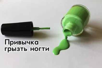 Шкідлива звичка гризти нігті (звичка) Шкідлива звичка гризти нігті