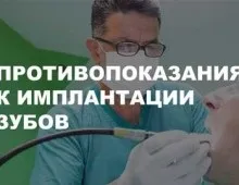 Термін служби імплантів зубів та коронок і як його продовжити (зубів) Термін служби імплантів зубів та коронок і як його продовжити