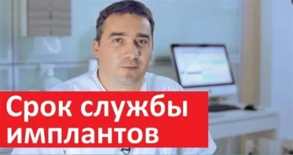 Термін служби зубних імплантів детальна інформація правила догляду за імплантатом