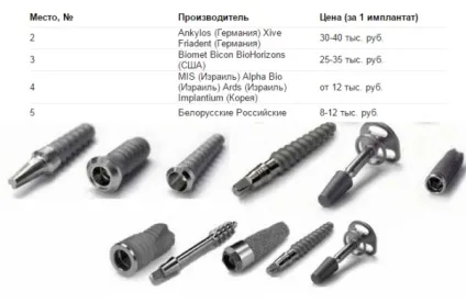 Термін служби зубних імплантів детальна інформація правила догляду за імплантатом
