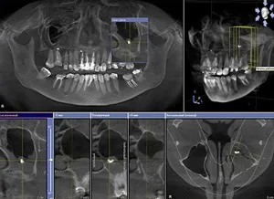 Стоматологія - айсберг - в московському районі у метро парк перемоги (дитяча стоматологія) Стоматологія - айсберг - в московському районі у метро парк перемоги