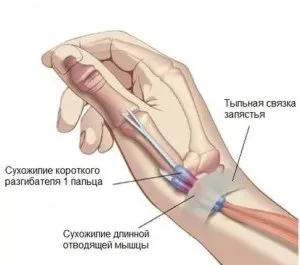 Стілоідіт лучезапястного суглоба симптоми, лікування (лікування) Стілоідіт лучезапястного суглоба симптоми, лікування