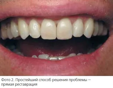 Стоматологічна «рожева естетика» (рожева) Стоматологічна «рожева естетика»