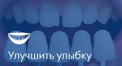 Стоматологія в Житомирі «ескулап» - мережа доступних стоматологічних клінік (стоматологія 23) Стоматологія в Житомирі «ескулап» - мережа доступних стоматологічних клінік
