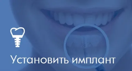 Стоматологія в Житомирі «ескулап» - мережа доступних стоматологічних клінік (хороший стоматолог) Стоматологія в Житомирі «ескулап» - мережа доступних стоматологічних клінік