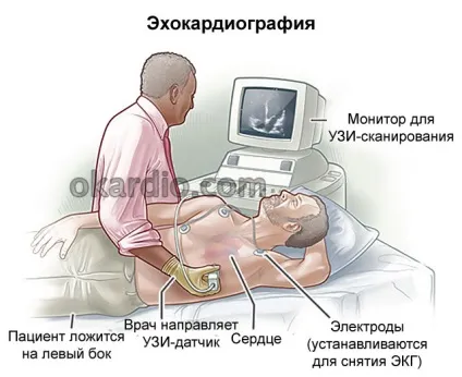 Стрес ехокардіографія що це таке, показання, види процедури (показання) Стрес ехокардіографія що це таке, показання, види процедури