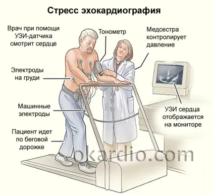 Стрес ехокардіографія що це таке, показання, види процедури (показання) Стрес ехокардіографія що це таке, показання, види процедури