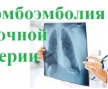 Хлоргексидину біглюконат для полоскання горла інструкція із застосування - як розводити (горла) Хлоргексидину біглюконат для полоскання горла інструкція із застосування - як розводити