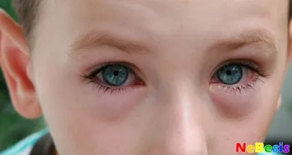 У кролика сльозяться очей - що робити (кошеня сльозяться очі) У кролика сльозяться очей - що робити