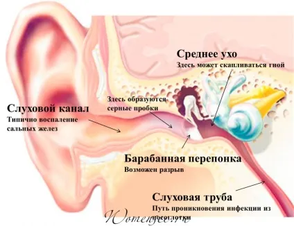 У дитини болить вухо що робити в домашніх умовах і як надати першу допомогу (болить) У дитини болить вухо що робити в домашніх умовах і як надати першу допомогу