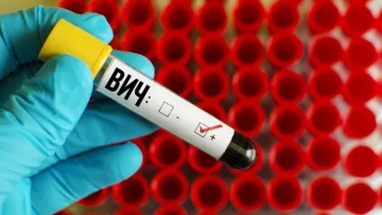 ВІЛ і СНІД в чому різниця, як проявляються захворювання (захворювання) ВІЛ і СНІД в чому різниця, як проявляються захворювання