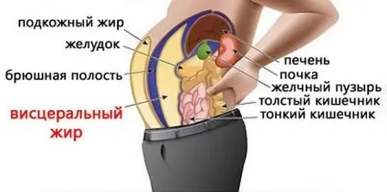Вісцеральні ожиріння, доктор гребені (ожиріння) Вісцеральні ожиріння, доктор Гребньов