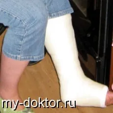 Відновлення після зняття гіпсу (будь-яку ділянку тіла) Відновлення після зняття гіпсу