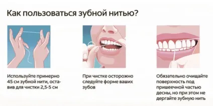 Зубна нитка для брекетів - як правильно вибрати і використовувати (нитка) Зубна нитка для брекетів - як правильно вибрати і використовувати