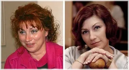 Зірки українського шоу-бізнесу до пластичних операцій і після них (45 фото) - Трініксі (таисия) Зірки українського шоу-бізнесу до пластичних операцій і після них (45 фото) - Трініксі