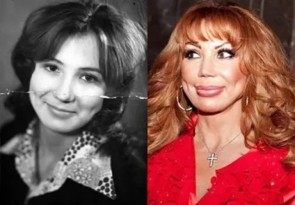 Зірки українського шоу-бізнесу до пластичних операцій і після них (45 фото) - Трініксі (татьяна) Зірки українського шоу-бізнесу до пластичних операцій і після них (45 фото) - Трініксі
