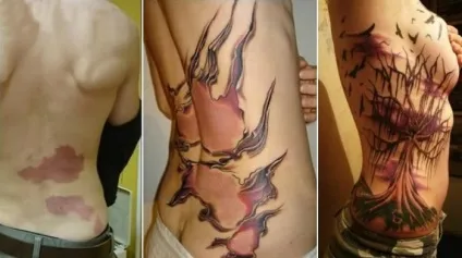 10 Оригінальних татуювань, які допомогли майстерно замаскувати шрами і інші дефекти шкіри