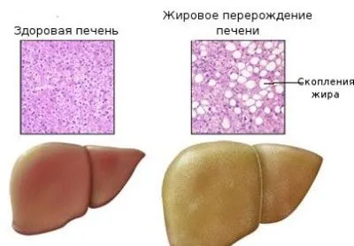 Амфетамін і алкоголь наслідки спільного вживання (амфетаміну алкогольними напоями) Амфетамін і алкоголь наслідки спільного вживання