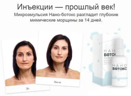 Алкоголь після уколів ботокса - я