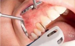 Апарат vector paro pro (новий вектор паро), durr dental (германію) - продаж та обслуговування (vector) Апарат vector paro pro (новий вектор паро), durr dental (германію) - продаж та обслуговування