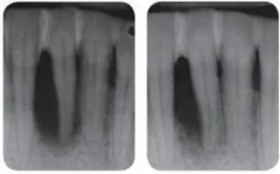 Апарат vector paro pro (новий вектор паро), durr dental (германію) - продаж та обслуговування (автоклав) Апарат vector paro pro (новий вектор паро), durr dental (германію) - продаж та обслуговування