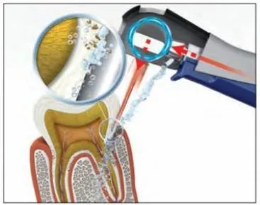 Апарат vector paro pro (новий вектор паро), durr dental (германію) - продаж та обслуговування (castellini) Апарат vector paro pro (новий вектор паро), durr dental (германію) - продаж та обслуговування