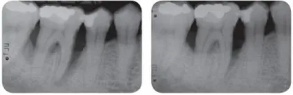 Апарат vector paro pro (новий вектор паро), durr dental (германію) - продаж та обслуговування (візіограф) Апарат vector paro pro (новий вектор паро), durr dental (германію) - продаж та обслуговування