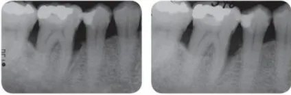 Апарат vector paro pro (новий вектор паро), durr dental (германію) - продаж та обслуговування (гріндент) Апарат vector paro pro (новий вектор паро), durr dental (германію) - продаж та обслуговування