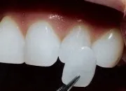Чим відрізняються кеди і кросівки, медицина в Одессае (кеди) Чим відрізняються кеди і кросівки, медицина в Одессае