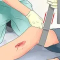 Що робити при ударі