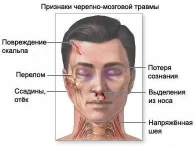 Що робити при ударі