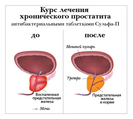 Що таке аутизм ознаки і лікування аутизму (аутизму) Що таке аутизм ознаки і лікування аутизму