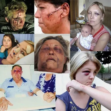 Доданий, я вбив їх тому, що вони білі (Білих Південній Африці) Доданий, я вбив їх тому, що вони білі