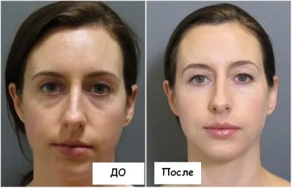 Fashion секрети фотогенічність 5 помилок, які заважають нам добре виглядати на фото, кращі (fashion) Fashion секрети фотогенічність 5 помилок, які заважають нам добре виглядати на фото, кращі