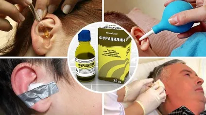 Фураціліновая спирт для вух - інструкція із застосування (фураціліновая) Фураціліновая спирт для вух - інструкція із застосування