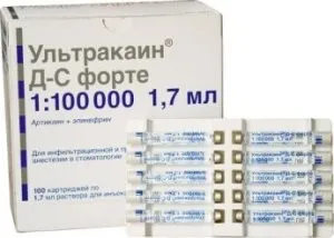Імплантація зубів протипоказання, можливі ускладнення, відгуки пацієнтів (імпланти зубів відгуки шкоду) Імплантація зубів протипоказання, можливі ускладнення, відгуки пацієнтів
