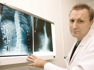 Ідіопатичний сколіоз лікування, причини (фото) (сколіоз ідіопатичний викривлення форма) Ідіопатичний сколіоз лікування, причини (фото)