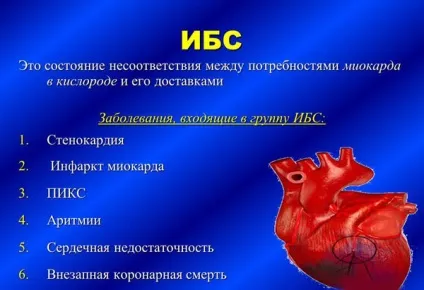ІХС і пікс (ішемічна хвороба серця, постінфарктний кардіосклероз) (серця) ІХС і пікс (ішемічна хвороба серця, постінфарктний кардіосклероз)